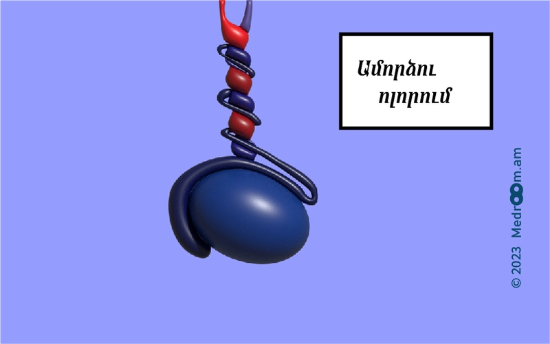 Ամորձու ոլորում